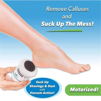 [🔥LAST PROMOTION&50% OFF] Electric Pedivac - Remove Your Callus Easily